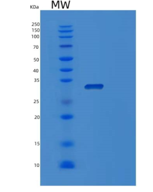Recombinant Human OSCAR Protein