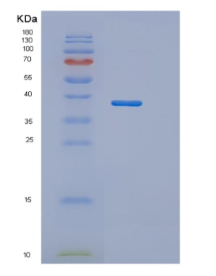 Recombinant Human OTC Protein