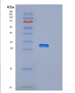 Recombinant Human OTUB2 Protein