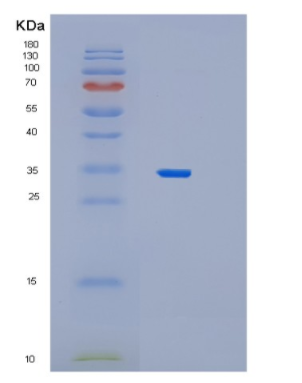 Recombinant Human PEX19 Protein