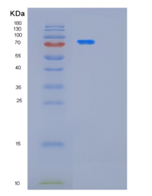 Recombinant Human PFKM Protein
