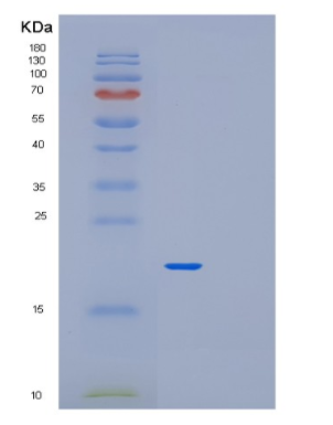 Recombinant Human PFDN2 Protein