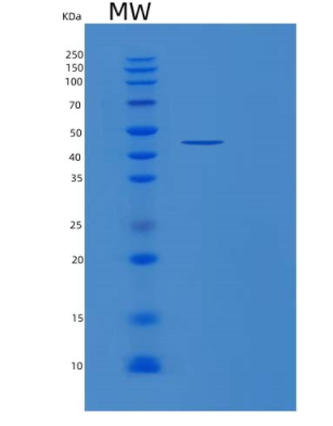 Recombinant Human PGK1 Protein