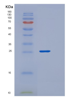 Recombinant Human PGLS Protein
