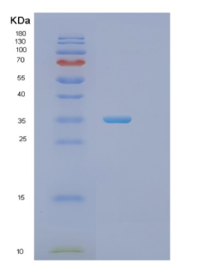 Recombinant Human PHB2 Protein