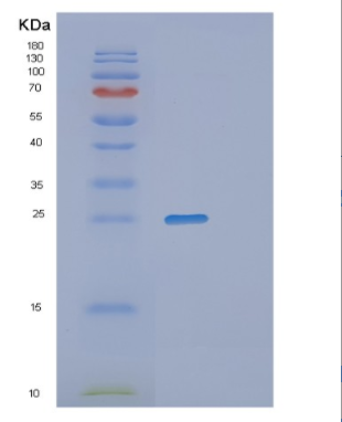 Recombinant Human PGP9.5 Protein