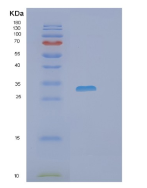Recombinant Human PHOSPHO1 Protein