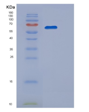Recombinant Human PGM1 Protein