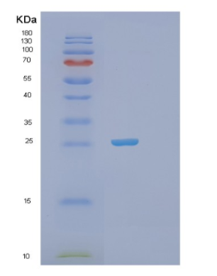 Recombinant Human Phosphoserine phosphatase Protein