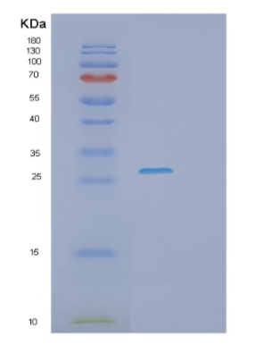 Recombinant Human PHOSPHO2 Protein