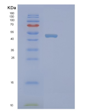 Recombinant Human PICK1 Protein