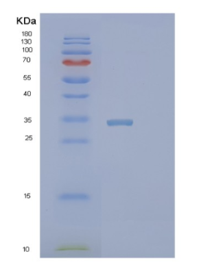 Recombinant Human PIR Protein