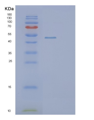 Recombinant Human PIP4K2B Protein