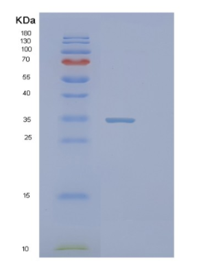 Recombinant Human PIH1D1 Protein