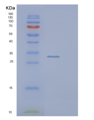 Recombinant Human PIM1 Protein