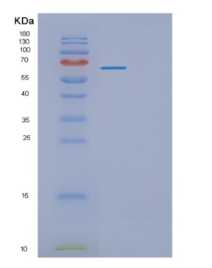 Recombinant Human Platelet endothelial cell adhesion molecule Protein