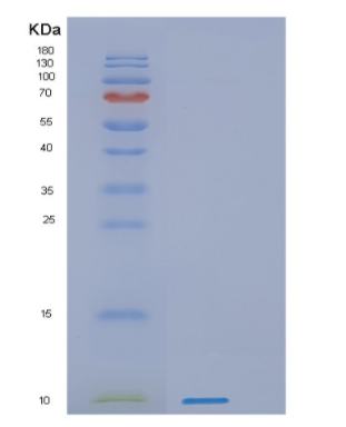 Recombinant Human PKIB Protein