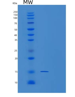 Recombinant Human PMP2 Protein
