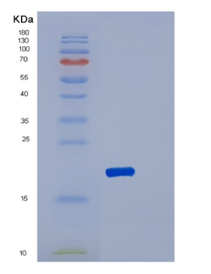 Recombinant Human PNOC Protein
