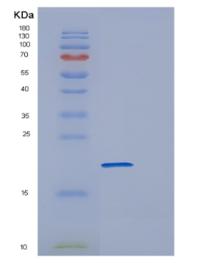 Recombinant Human POLR2H Protein