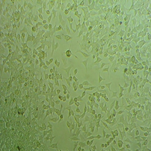 C8166-CD4细胞