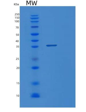 Recombinant Human PPA1 Protein