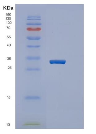 Recombinant Human PPARG Protein