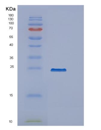 Recombinant Human PPCDC Protein