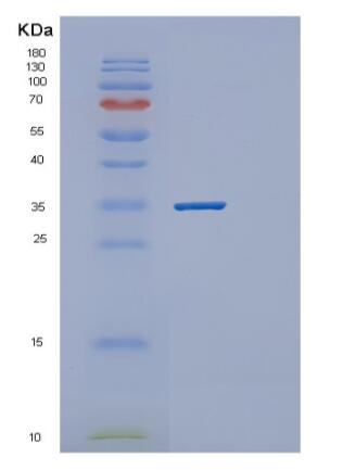 Recombinant Human PPCS Protein