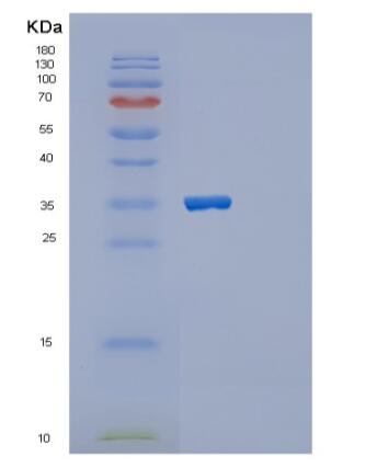 Recombinant Human PPP1R3B Protein
