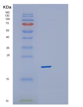 Recombinant Human PPP3R1 Protein