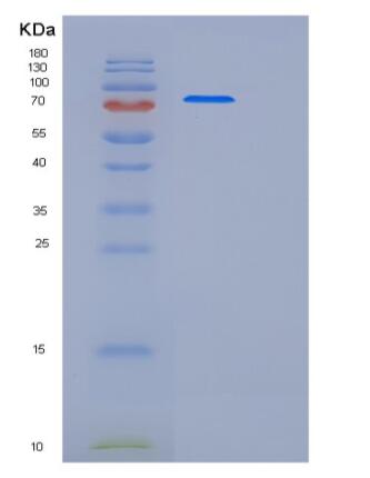 Recombinant Human PREP Protein