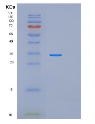 Recombinant Human PRKAA1 Protein