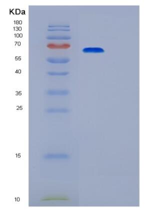 Recombinant Human PRKACA Protein