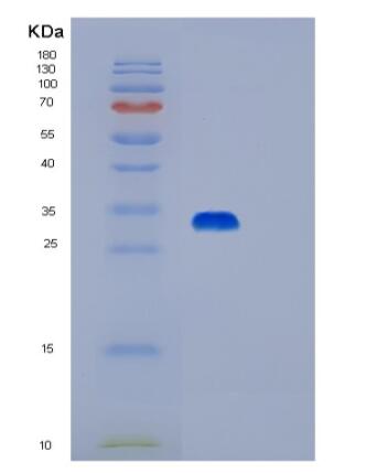 Recombinant Human PRKAB2 Protein