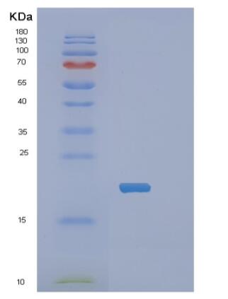 Recombinant Human PPP1R14A Protein