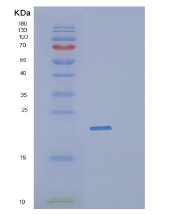 Recombinant Human PPP1R2 Protein