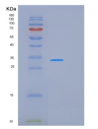 Recombinant Human PRDX4 Protein