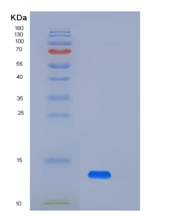 Recombinant Human Prealbumin Protein