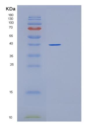 Recombinant Human PRKAG1 Protein