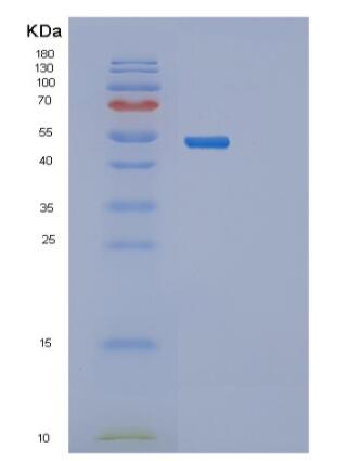 Recombinant Human PRKAR2A Protein
