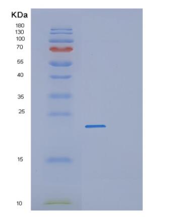 Recombinant Human PRL-3 Protein