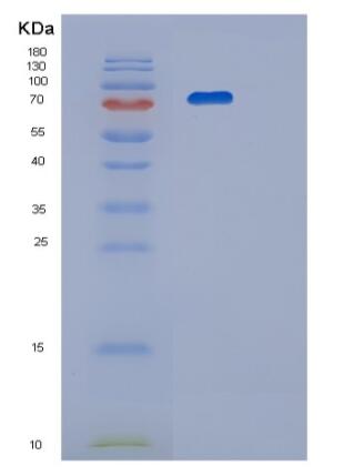 Recombinant Mouse PRMT1 isoform2 Protein
