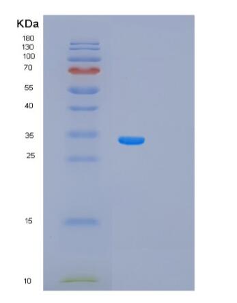Recombinant Human PRKAB1 Protein
