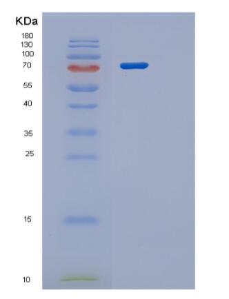 Recombinant Human PRMT1 isoform3 Protein