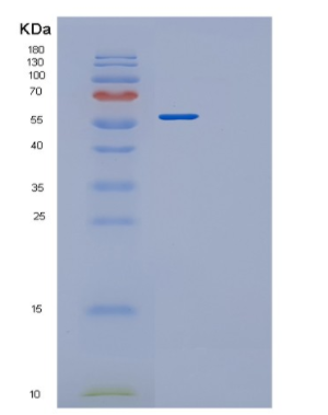 Recombinant Human PRMT3 Protein