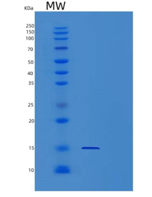 Recombinant Human Profilin 1 Protein