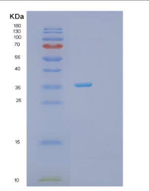 Recombinant Human PRPS1 Protein