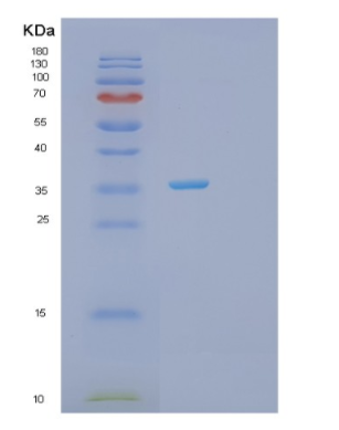 Recombinant Human PRPS2 Protein