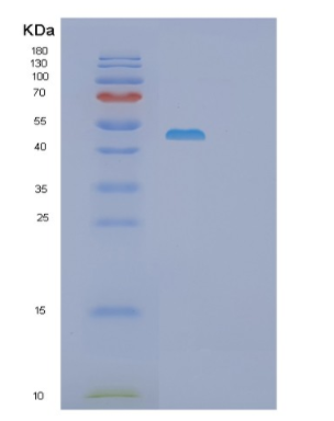Recombinant Human PSG1 Protein